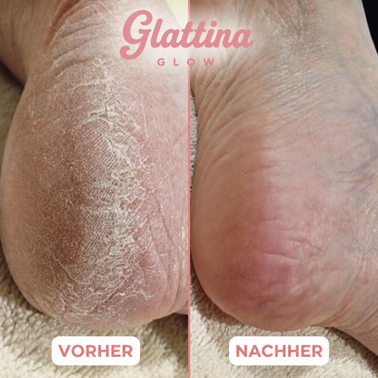 Glattina Glow Balsam