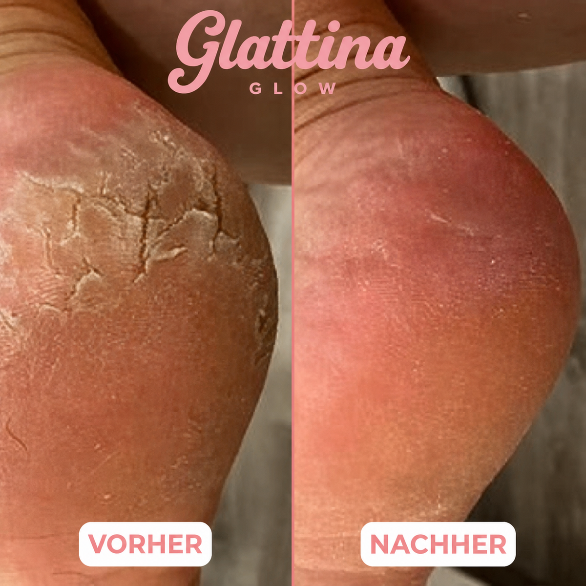 Glattina Glow Balsam