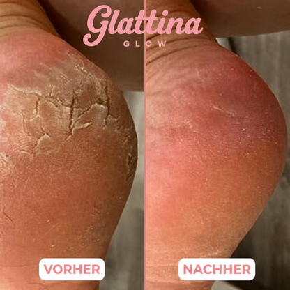 Glattina Glow Balsam