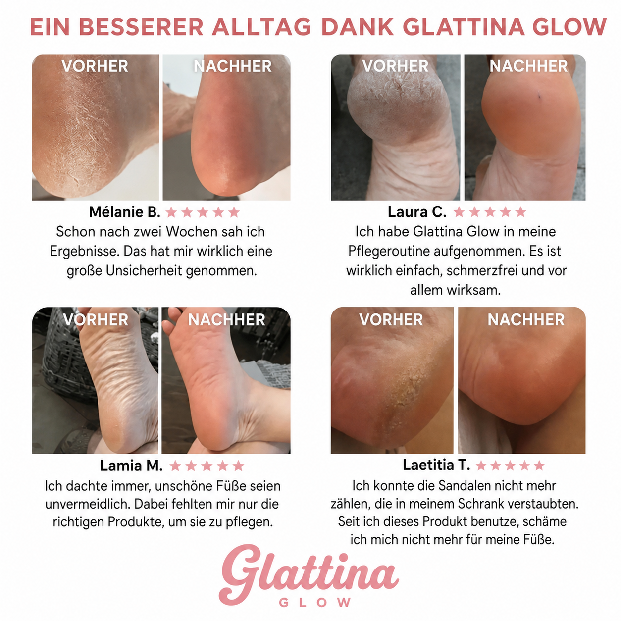 GlattinaGlow™ – Kit Beauté Pieds