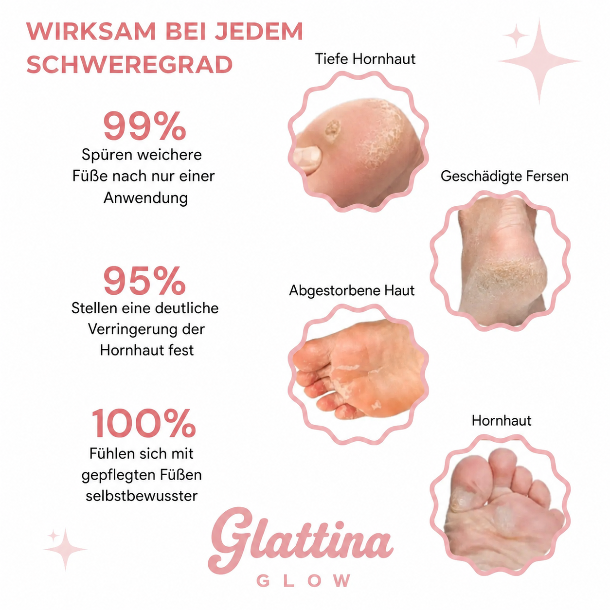 GlattinaGlow™ – Kit Beauté Pieds