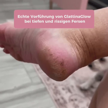 GlattinaGlow™ – Kit Beauté Pieds
